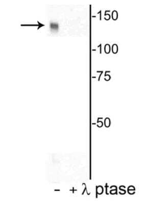 Western Blot: DENND3 [p Thr450] Antibody [NBP3-11946]