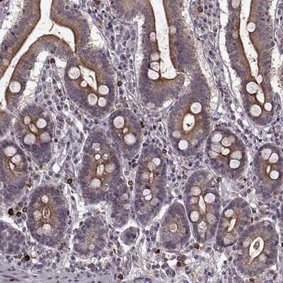 Immunohistochemistry-Paraffin: DENND4B Antibody [NBP2-68913]