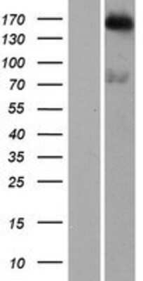 Western Blot: DENND4B Overexpression Lysate [NBP2-07260]