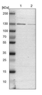 Western Blot: DENND4C Antibody [NBP1-90788]