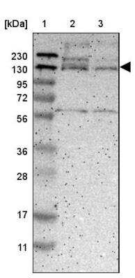 Western Blot: DENND4C Antibody [NBP1-90788]