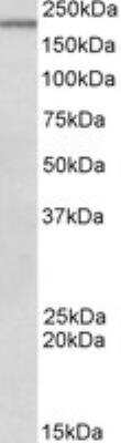 Western Blot: DENND4C Antibody [NBP2-27475]