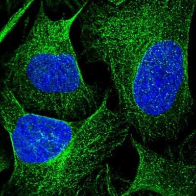 Immunocytochemistry/ Immunofluorescence: DENND5B Antibody [NBP2-31971]