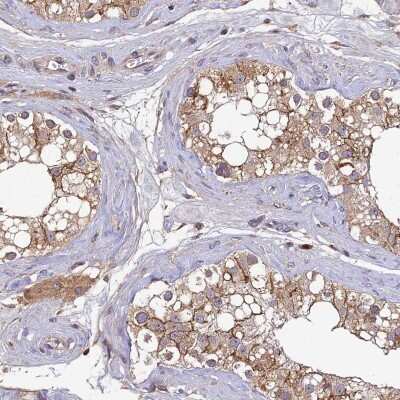 Immunohistochemistry-Paraffin: DENND5B Antibody [NBP2-31971]