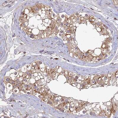 Immunohistochemistry-Paraffin: DENND5B Antibody [NBP2-31971]