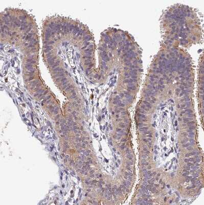 Immunohistochemistry-Paraffin: DENND5B Antibody [NBP2-31971]