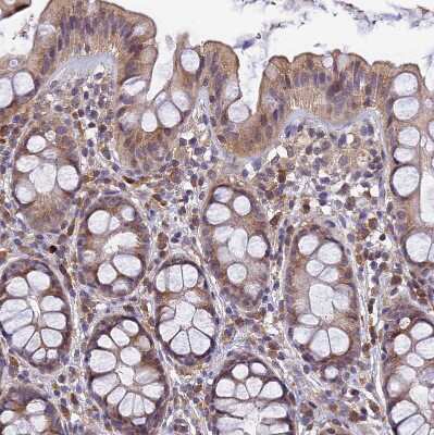 Immunohistochemistry-Paraffin: DENND5B Antibody [NBP2-31971]