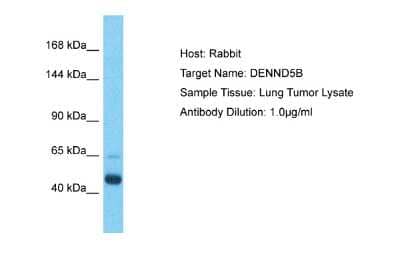 Western Blot: DENND5B Antibody [NBP2-82837]