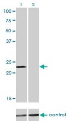 Western Blot: DENR Antibody (1H3) [H00008562-M01]