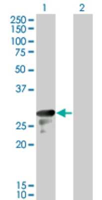 Western Blot: DENR Antibody (1H3) [H00008562-M01]
