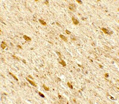 Immunohistochemistry: DENR Antibody - BSA Free [NBP2-81811]