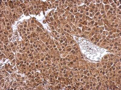 Immunohistochemistry-Paraffin: DENR Antibody [NBP2-16148]