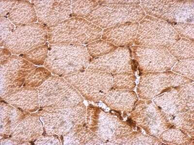 Immunohistochemistry-Paraffin: DENR Antibody [NBP2-16148]