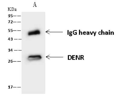 Immunoprecipitation: DENR Antibody [NBP2-97745]