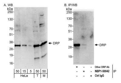 Western Blot: DENR Antibody [NBP1-50042]