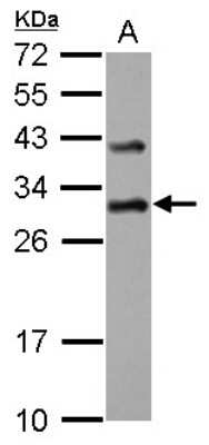 Western Blot: DENR Antibody [NBP2-16148]