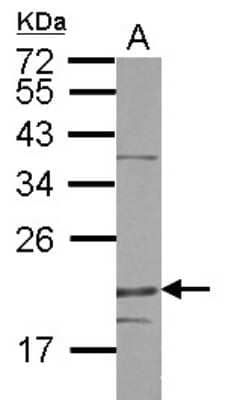 Western Blot: DENR Antibody [NBP2-16148]