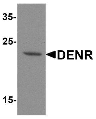 Western Blot: DENR AntibodyBSA Free [NBP2-81811]