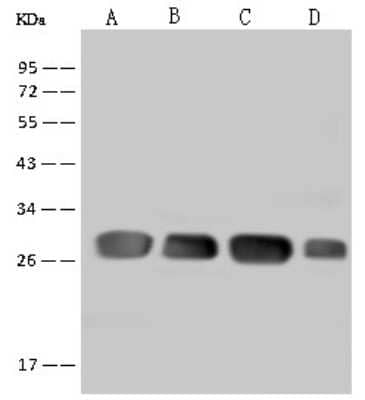 Western Blot: DENR Antibody [NBP2-97745]