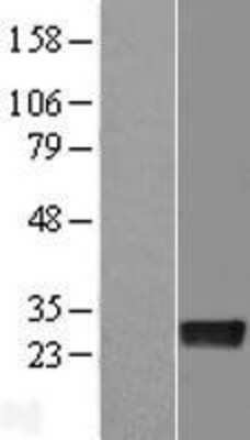 Western Blot: DENR Overexpression Lysate [NBL1-09832]