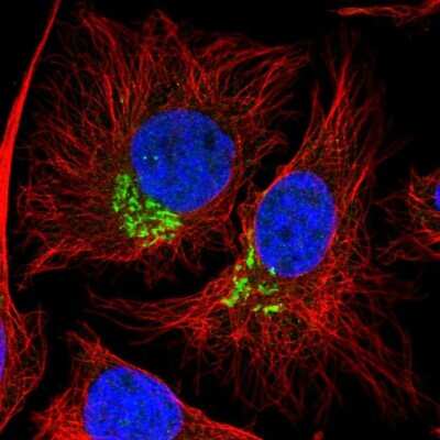 Immunocytochemistry/ Immunofluorescence: DEP Domain Containing 5 Antibody [NBP2-30444]