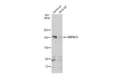 Western Blot: DEP Domain Containing 5 Antibody [NBP3-13258]