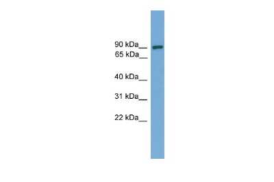 Western Blot: DEPDC1A Antibody [NBP2-84002]