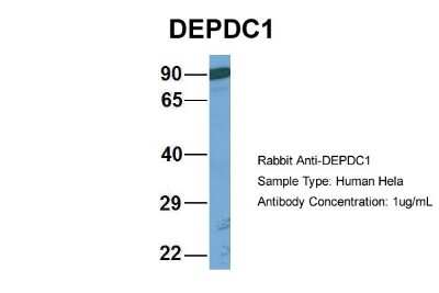 Western Blot: DEPDC1A Antibody [NBP2-84002]