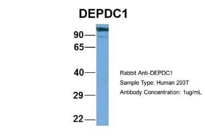 Western Blot: DEPDC1A Antibody [NBP2-84002]