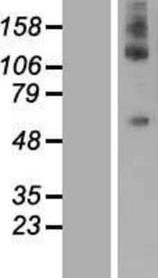 Western Blot: DEPDC1A Overexpression Lysate [NBL1-09833]