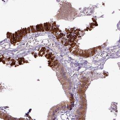 Immunohistochemistry-Paraffin: DEPDC1B Antibody [NBP2-56444]