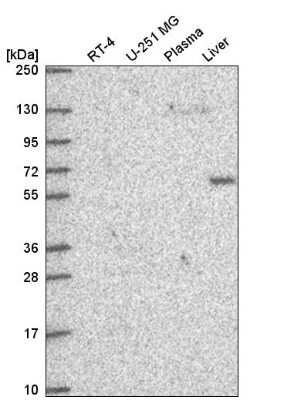 Western Blot: DEPDC1B Antibody [NBP2-56444]