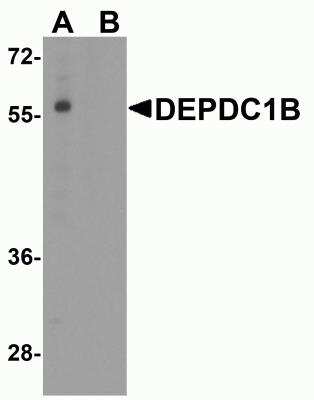 Western Blot: DEPDC1B AntibodyBSA Free [NBP2-81913]