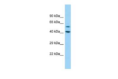 Western Blot: DEPDC1B Antibody [NBP2-84777]