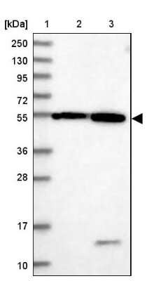 Western Blot: DEPDC4 Antibody [NBP1-90592]