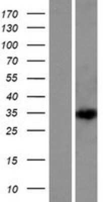 Western Blot: DEPDC4 Overexpression Lysate [NBP2-05403]