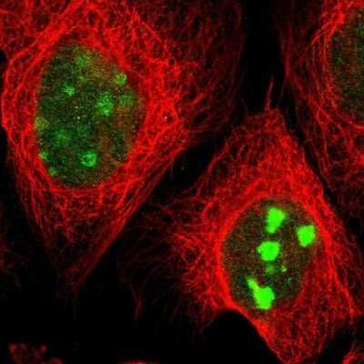 Immunocytochemistry/ Immunofluorescence: DEPDC7 Antibody [NBP1-86068]