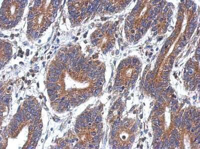 Immunohistochemistry-Paraffin: DEPDC7 Antibody [NBP2-16150]