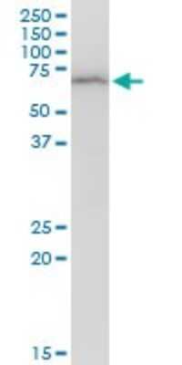 Western Blot: DEPDC7 Antibody [H00091614-B01P]