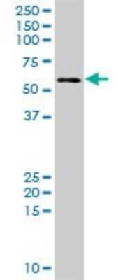 Western Blot: DEPDC7 Antibody [H00091614-B01P]