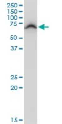 Western Blot: DEPDC7 Antibody [H00091614-B01P]