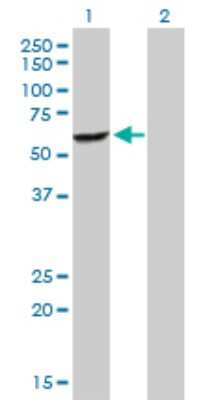 Western Blot: DEPDC7 Antibody [H00091614-D01P]