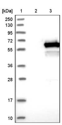 Western Blot: DEPDC7 Antibody [NBP1-86068]