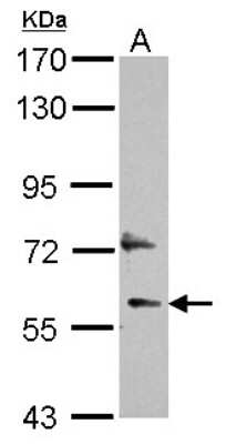 Western Blot: DEPDC7 Antibody [NBP2-16150]