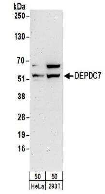 Western Blot: DEPDC7 Antibody [NBP2-32141]