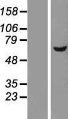 Western Blot: DEPDC7 Overexpression Lysate [NBL1-09836]