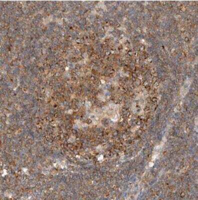 Immunohistochemistry: DEPTOR/DEPDC6 Antibody [NBP1-85256]