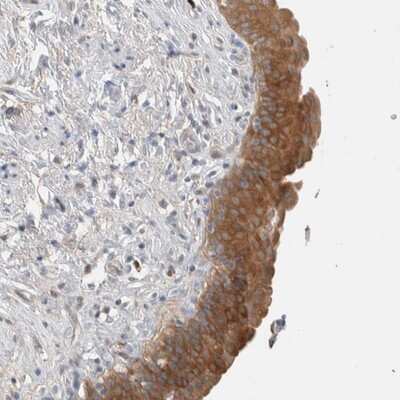 Immunohistochemistry-Paraffin: DEPTOR/DEPDC6 Antibody [NBP1-85255]