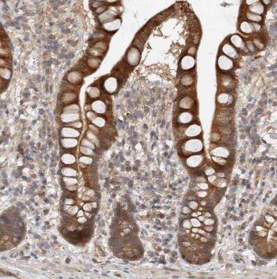 Immunohistochemistry-Paraffin: DEPTOR/DEPDC6 Antibody [NBP1-85257]