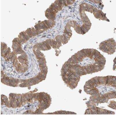 Immunohistochemistry-Paraffin: DEPTOR/DEPDC6 Antibody [NBP1-85257]